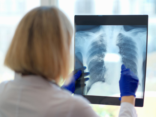 Pneumolog: kódy zdravotních výkonů