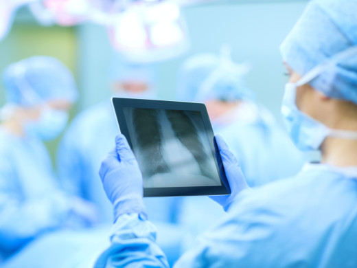 Český program transplantace plic je na špici Evropy