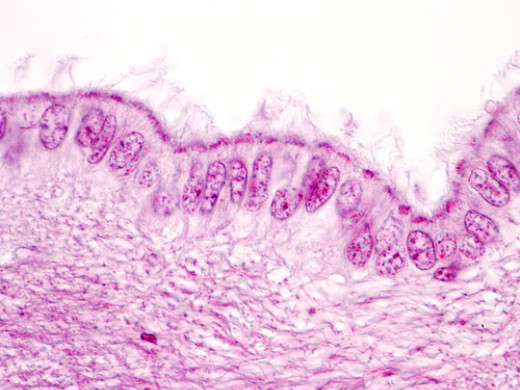 Vztah mezi poškozením cilií a schizofrenií